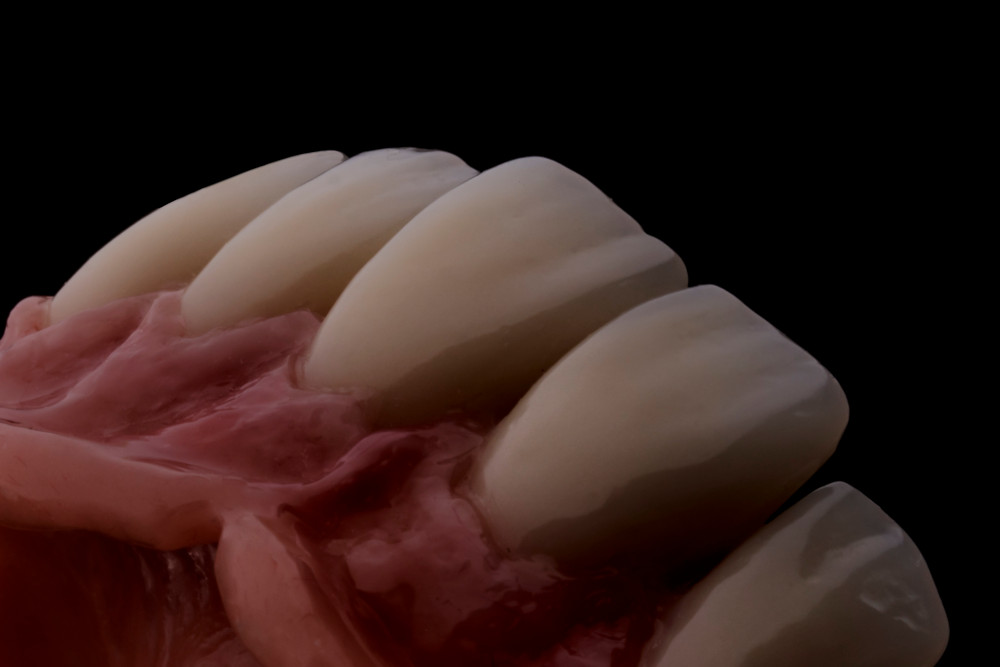 Prothesen-Zähne